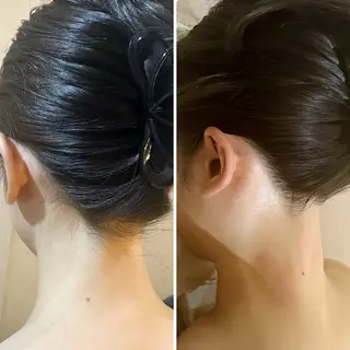 うなじ脱毛/美肌脱毛 LABELのエステ・リラクイメージ