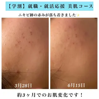 Bellesthe (ベルエステ)のエステ・リラクイメージ