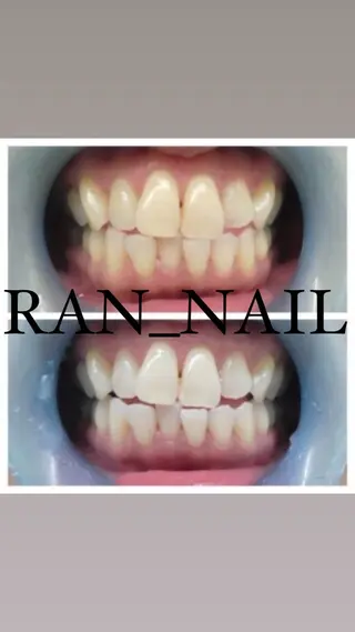 志免町 フェイスシャルエステのエステ・リラクイメージ