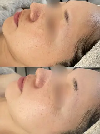 大阪/高槻　salon me.所属・仲原 杏菜のエステ・リラクイメージ