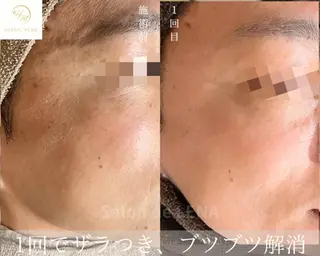ハーブピーリング・毛穴ケア専門サロンSalon de LENA 栄店所属・ハーブピーリング専門 サロンドレナ　白藤のエステ・リラクイメージ