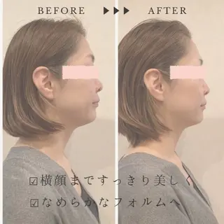 小顔×肌質改善サロン soin〔ソワン〕のエステ・リラクイメージ