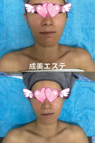 新大久保成美 エステ（エリカ）のエステ・リラクイメージ