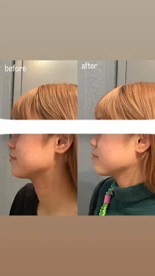 エステサロンino.colore'所属・小顔サロン ino.coloreのエステ・リラクイメージ