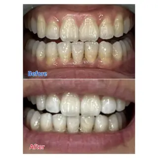 MBEAUTYSALON 千葉店・京成大久保所属・Melty 輝のその他イメージ