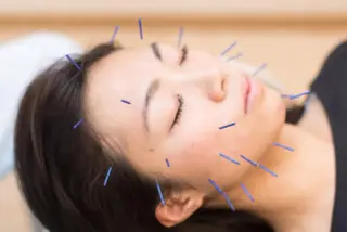 Acupuncture  salon LINOA リノア鍼灸院所属・ヘッドスパ鍼/小顔鍼 耳ツボ 　LINOAのエステ・リラクイメージ