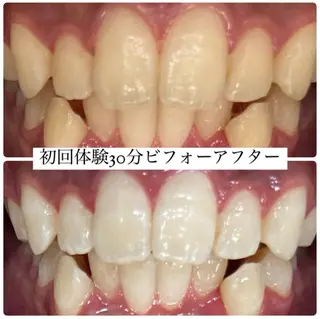 PLATINUM Beauty 横浜店所属・ホワイトニングルーム 横浜店のその他イメージ