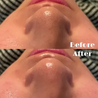 💎美容革命ラボ💎 大名店のエステ・リラクイメージ