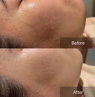 for woman所属・森 美優のエステ・リラクイメージ