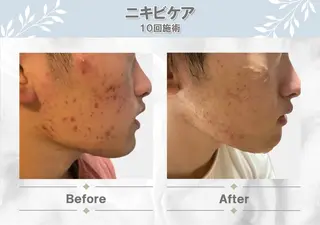 MODE K's 白石彩夏のエステ・リラクイメージ