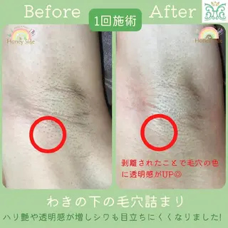 剥離するハーブ🌈 Honey Sideのエステ・リラクイメージ