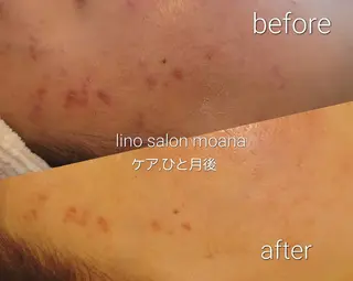 lino salon moana所属・lino salon  moanaのエステ・リラクイメージ