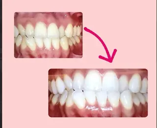 ecxia white 高田馬場所属・セルフホワイトニング エクシア 高田馬場のその他イメージ