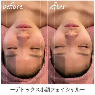 シミケアサロン REVIASオーナーのエステ・リラクイメージ