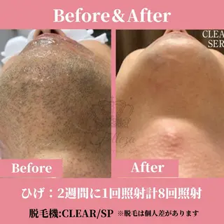 メンズ 有人型セルフサロン 脱毛/痩身/美顔のその他イメージ