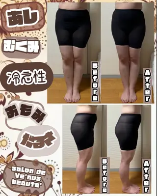 ヴィーナス ビューティーのエステ・リラクイメージ