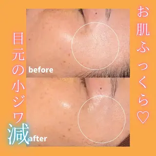 痩身&美肌サロン ビュースタ 伊藤🌷のエステ・リラクイメージ
