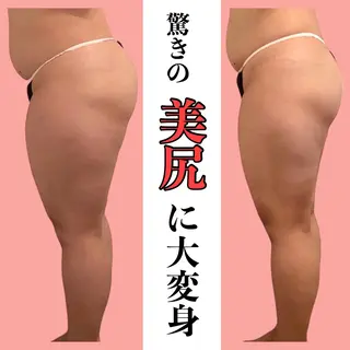 タマンサリ所属・タマンサリ 黒木のエステ・リラクイメージ