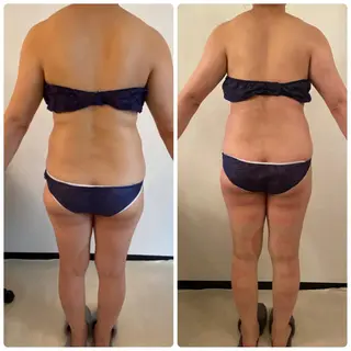 FLEUR大阪・整体 ・ハイフ・痩身・小顔のエステ・リラクイメージ