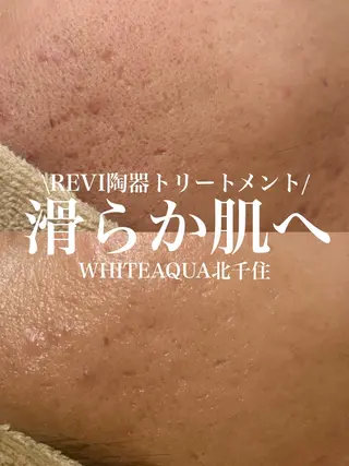 WHITE AQUA 北千住店のエステ・リラクイメージ