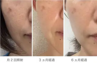 MyFairLady miuのエステ・リラクイメージ