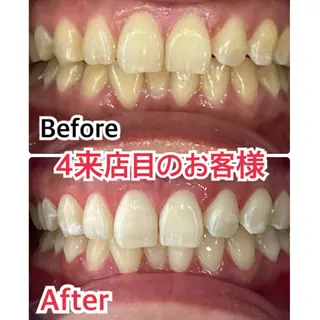 プラチナムビューティー柏所属・【歯科提携】柏ホワイ トニングスタイルのその他イメージ