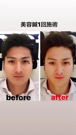 鍼灸整骨院Refine所属・鍼灸 Refineのその他イメージ