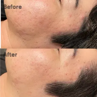 美容鍼/鍼灸 ここみ鍼灸院のエステ・リラクイメージ