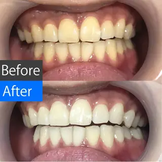 ミディアム パーマ ネイル カラー キッズ ヘアアレンジ マツエク・マツパ メンズ アイブロウ 中目黒 ホワイトニングサロンのその他イメージ