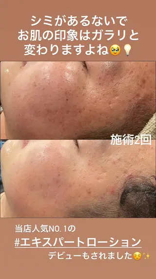 LiZA エステティックサロンのエステ・リラクイメージ