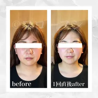 部分痩せ♥️小顔専門 MIKUのエステ・リラクイメージ