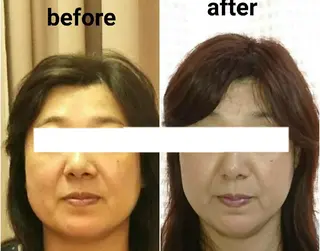 小顔と美肌 まごころエステMatoria所属・小顔 美肌専門 Matoriaのエステ・リラクイメージ