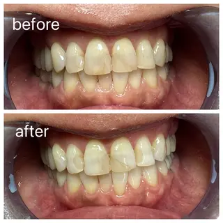 セルフホワイトニング Shineeのエステ・リラクイメージ