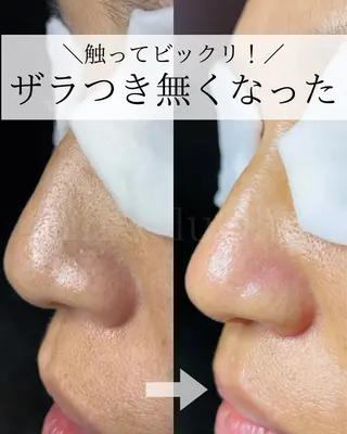 毛穴汚れ改善専門店/ 岸和田/リヒオルオルのエステ・リラクイメージ