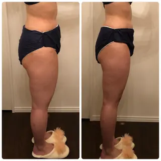 FLEUR大阪・美容 整体・痩身・小顔のエステ・リラクイメージ