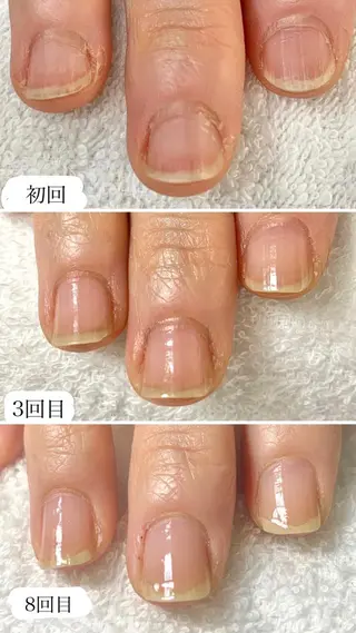 ネイル Ka pilina所属・自爪育成専門店 Kapilinaのネイルデザイン