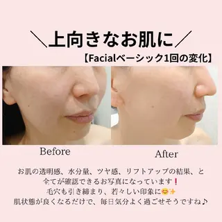 PRETTIEST SHINE所属・山田 浩子のエステ・リラクイメージ