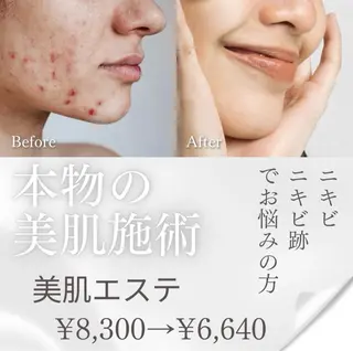 メンズ キッズ 肌質改善・脱毛サロン Luangeのエステ・リラクイメージ