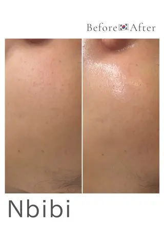 韓国🇰🇷価格 サロン_Nbibiのエステ・リラクイメージ