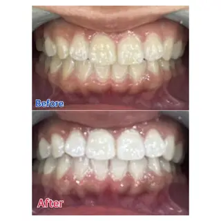 MBEAUTYSALON 千葉店・京成大久保所属・Melty 輝のその他イメージ