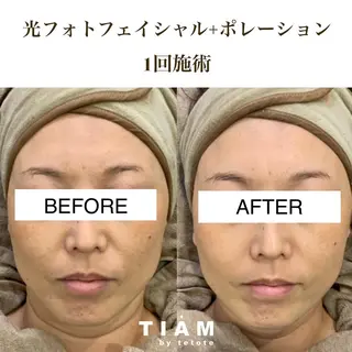 美肌サロンTIAM by tetoteのエステ・リラクイメージ