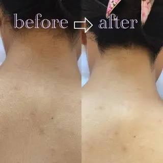 フェミニンエステ ティック大阪福島店のエステ・リラクイメージ