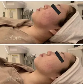 ✨美肌水光✨ アトリエリュバンのエステ・リラクイメージ