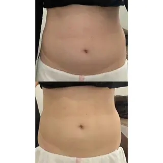 OPREA 千種店のエステ・リラクイメージ