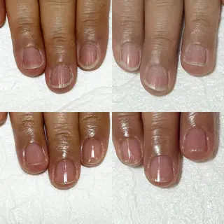 ネイル 自爪育成・巻き爪 補正講師　津蔵のネイルデザイン