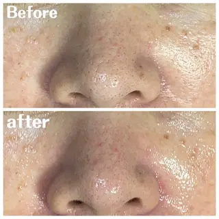 肌質改善サロン facialmoonのエステ・リラクイメージ