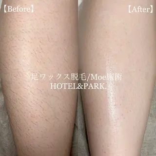 HOTEL&PARK .Moeワックス脱毛のエステ・リラクイメージ