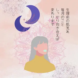 皮膚科より効果あり ⁉️最短ニキビ改善のエステ・リラクイメージ