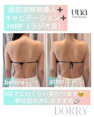 UNA SHIROKANE所属・脂肪冷却サロンUNA SHIROKANEのその他イメージ