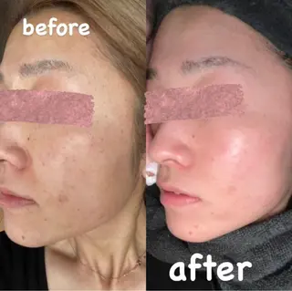 beauty lanaのエステ・リラクイメージ